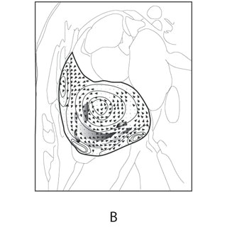 motion estimation of in plane mr signals based on schematic display of a