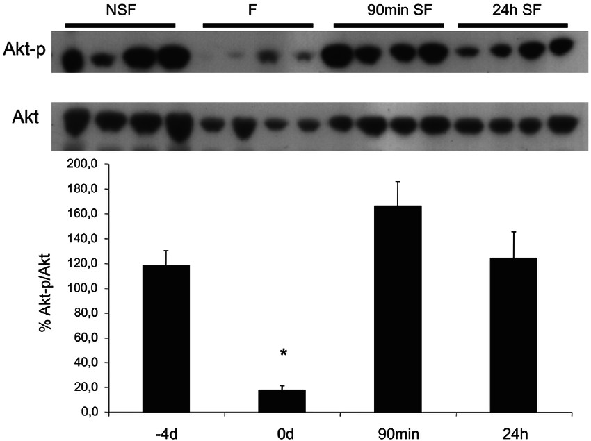 top a representative western blot for phospho akt during non satiation feeding nsf 2 4d after 4 days of fasting f 0d