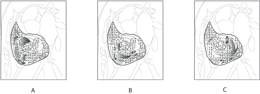 motion estimation of in plane mr signals based on schematic display of download scientific diagram