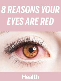 8 reasons your eyes are red and how to treat them