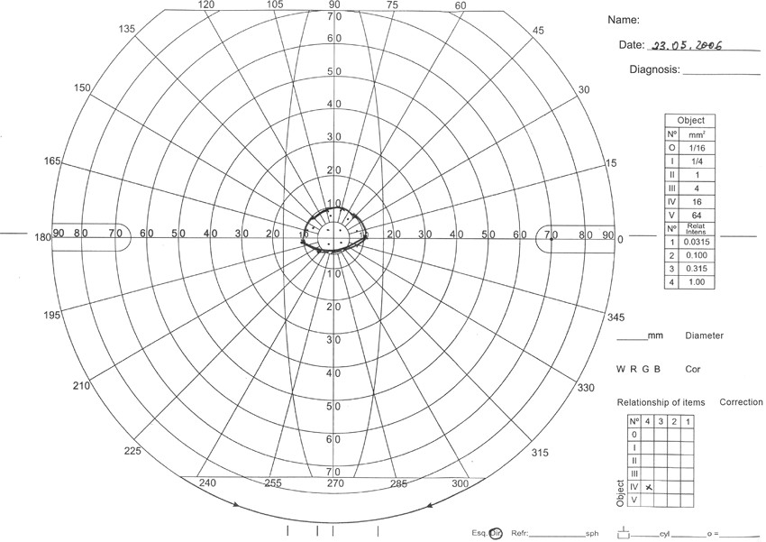 manual perimetry in od abbreviation od right eye