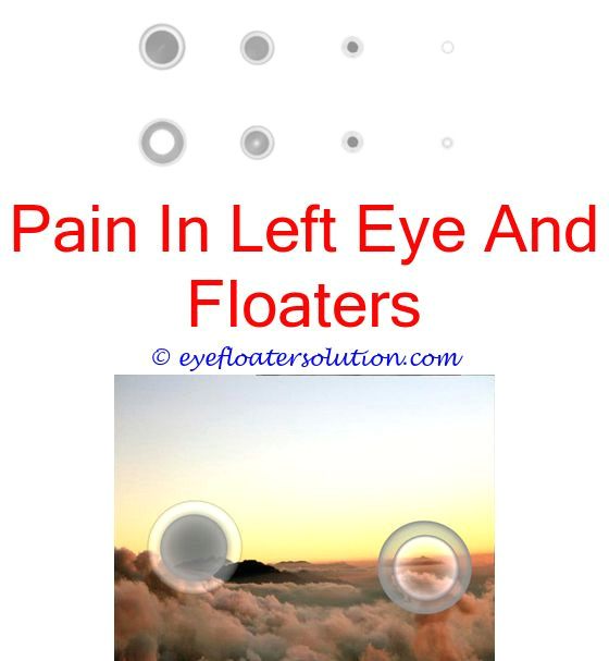 eye floaters that look like worms are eye floaters serious what are eye floaters a sign of i got rid of my eye floaters eyes light sensitivity floaters