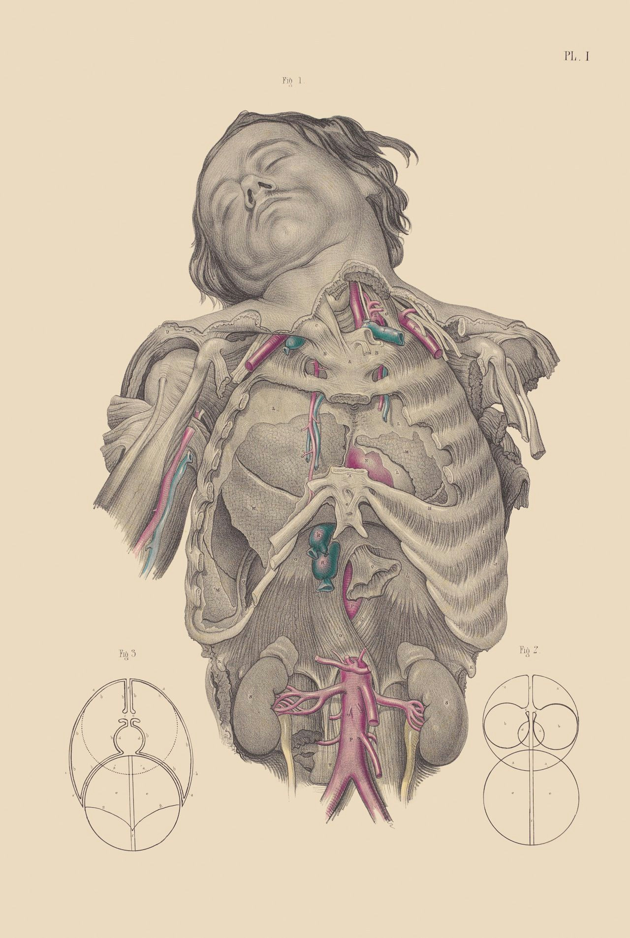 dissection of the thorax showing the relative position of the lungs heart and primary blood vessels gruesome and surreal surgical illustrations from the
