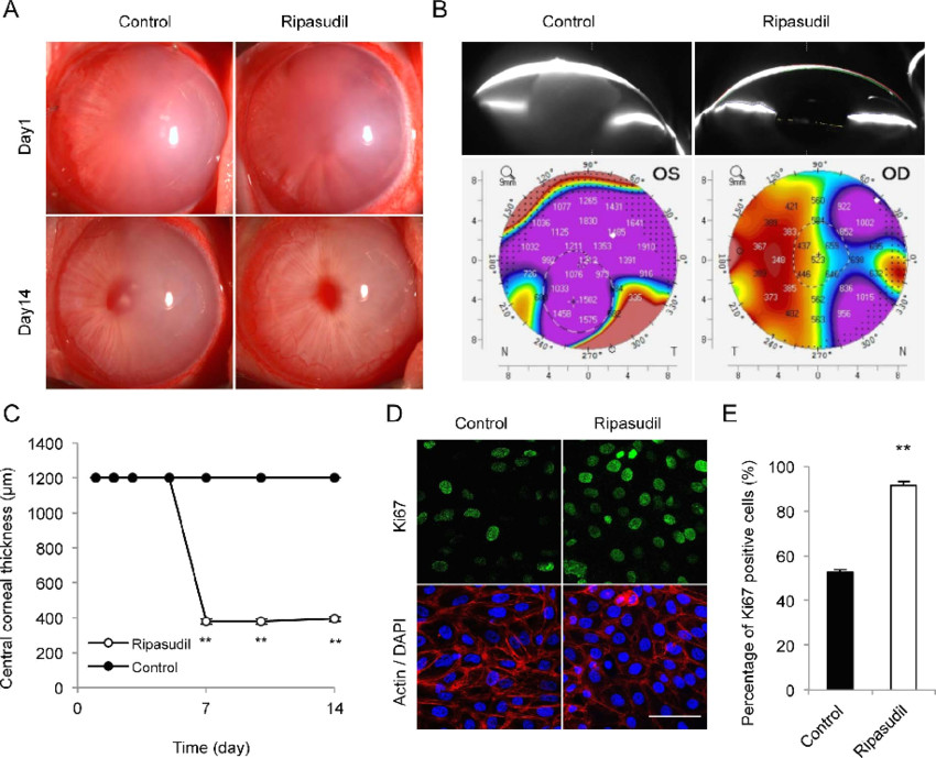 effect of ripasudil eye drops on wound healing in a mechanical damage download scientific diagram