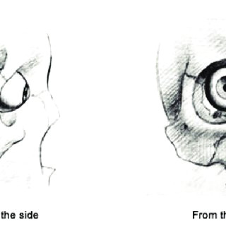 the position f the eye in its socket wolff 1933