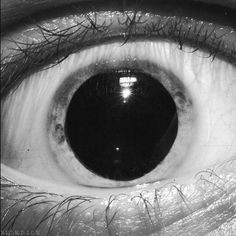 eye drugs and eyes kep