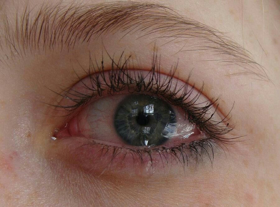 eyes photos eyes pics eye infection symptoms glaucoma symptoms red aesthetic