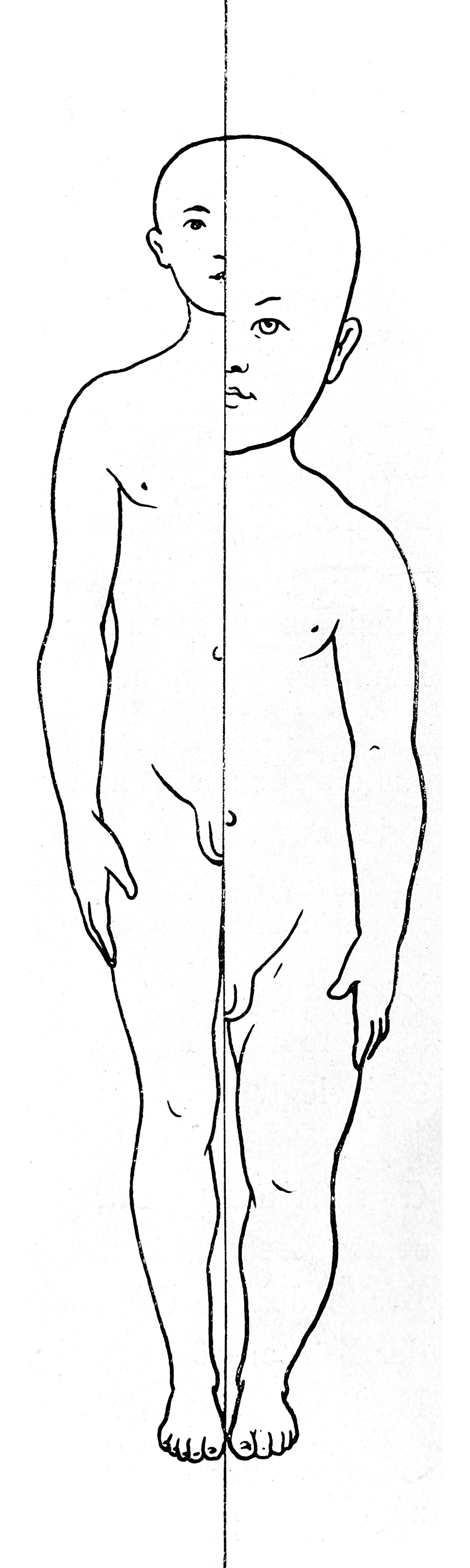 variation of proportion with age
