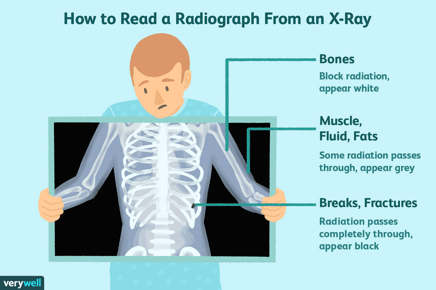 how to read a radiograph from an x ray