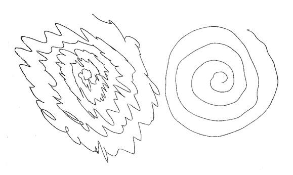 spiral drawing essential tremor jpg