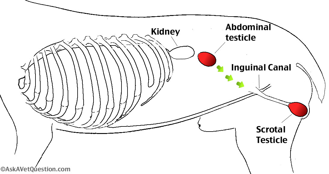 cryptorchidism