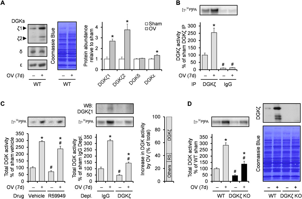 a dgki foxo ubiquitin proteolytic axis controls fiber size during skeletal muscle remodeling