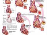 Drawing Of Heart Disease 367 Best Heart Disease News and Information Images In 2019