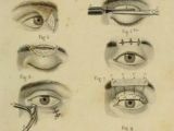 Medical Drawing Of An Eye 236 Best Vintage Medical Illustrations Images Human Anatomy